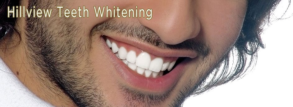 Whitening