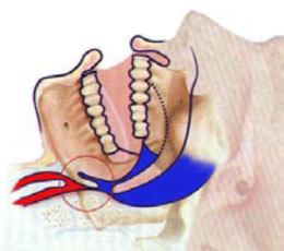 Airway Airway