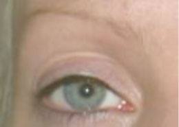 eyebrows_before