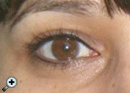 eyes_after