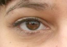 eyes_before