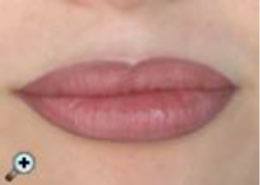 lips_after