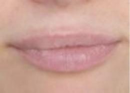 lips_before
