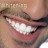 Whitening